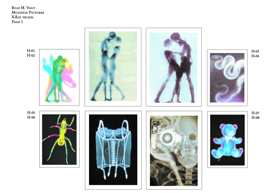 X-ray techn